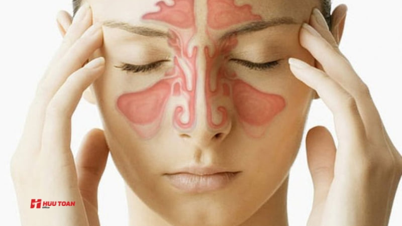 15 Bệnh của dân văn phòng thường gặp và cách phòng tránh Viêm xoang